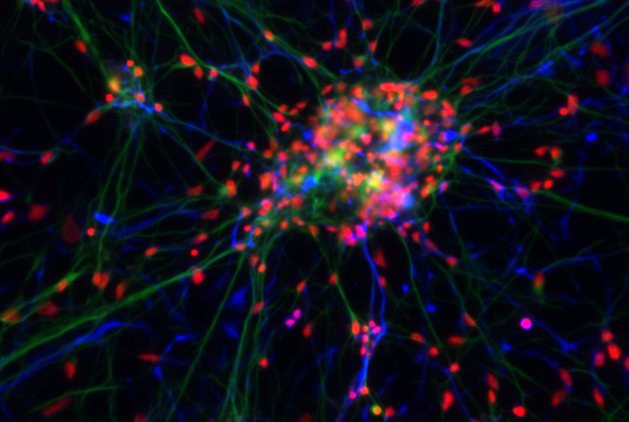 R12 neuron, multi wavelength fluorescence